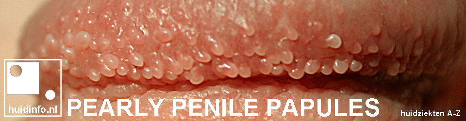 papules pictures